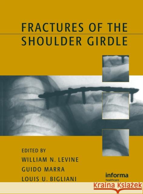 Fractures of the Shoulder Girdle Henry C. Thode William N. Levine Guido Marra 9780824708986 