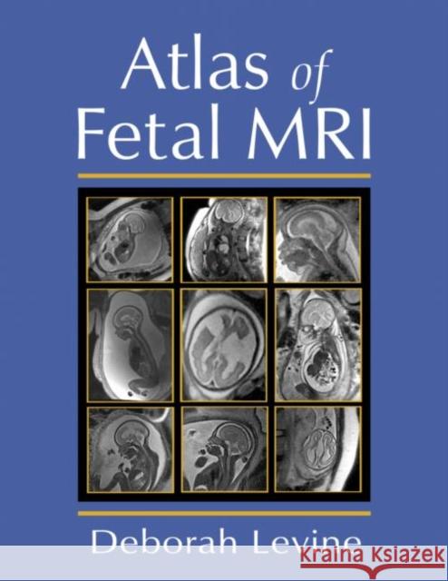 Atlas of Fetal MRI Deborah Levine 9780824725488 