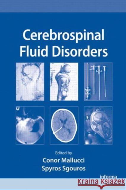 Cerebrospinal Fluid Disorders Thomas Abbott  Abbott Conor Mallucci 9780824728335