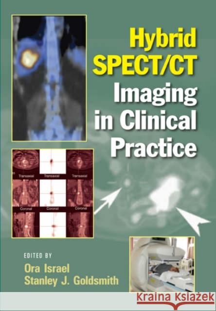 Hybrid SPECT/CT Imaging in Clinical Practice Ora Israel Stanley J. Goldsmith 9780824728540 Informa Healthcare
