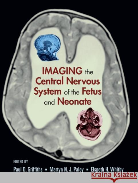 Imaging the Central Nervous System of the Fetus and Neonate Paul D. Griffiths Martyn N. J. Paley Elspeth H. Whitby 9780824728564 Taylor & Francis