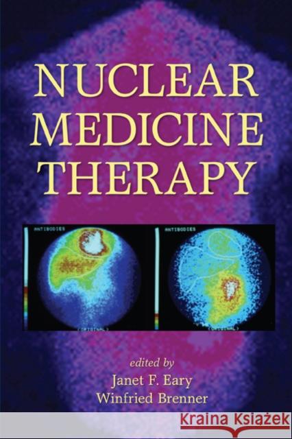 Nuclear Medicine Therapy Janet F. Eary Winfried Brenner 9780824728762 Informa Healthcare