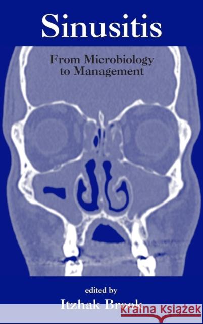 Sinusitis: From Microbiology to Management Brook, Itzhak 9780824729486 Informa Healthcare