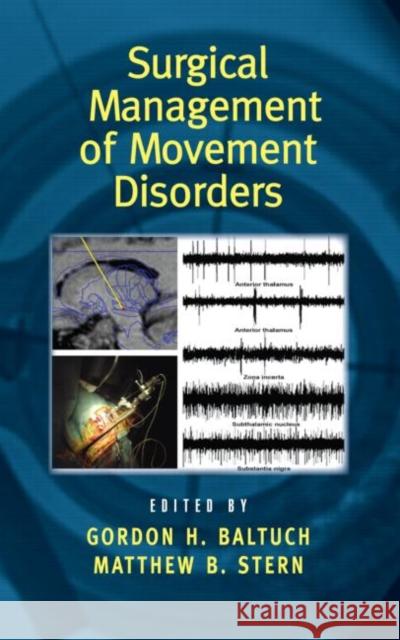 Surgical Management of Movement Disorders Gordon H. Baltuch Matthew B. Stern 9780824729509