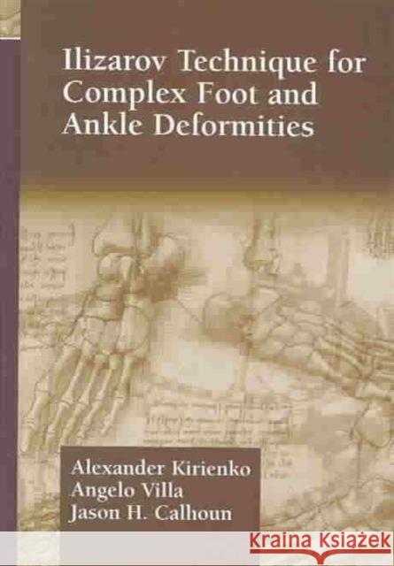 Ilizarov Technique for Complex Foot and Ankle Deformities Alexander Kirienko Angelo Villa A. Kirienko 9780824747893 Taylor & Francis Group