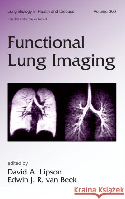 Functional Lung Imaging David A. Lipson Edwin J. R. Va 9780824754273 Taylor & Francis Group
