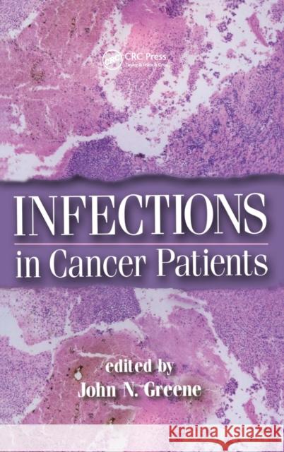 Infections in Cancer Patients Greene N. Greene John N. Greene 9780824754372 Informa Healthcare