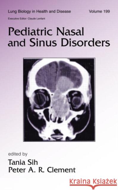 Pediatric Nasal and Sinus Disorders Sih                                      Sih Sih Tania Sih 9780824754488 Informa Healthcare