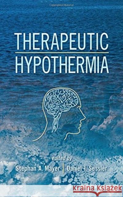 Therapeutic Hypothermia Stephan A. Mayer Daniel Sessler Mayer A. Mayer 9780824754785 Informa Healthcare