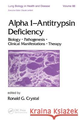 Alpha 1 - Antitrypsin Deficiency: Biology-Pathogenesis-Clinical Manifestations-Therapy    9780824788483 Taylor & Francis