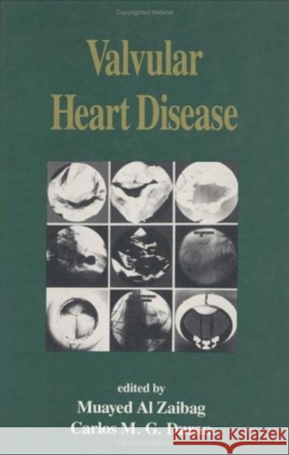 Valvular Heart Disease Muayed Al-Zaibag Al-Zaibag                                Muayed Ed. Zaibag 9780824788612 Informa Healthcare