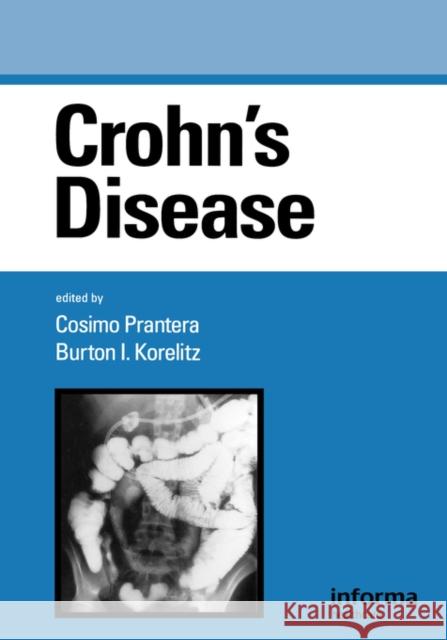 Crohn's Disease Cosimo Prantera Burton I. Korelitz 9780824794101 Marcel Dekker