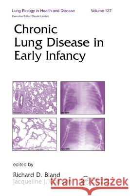Chronic Lung Disease in Early Infancy Richard D. Bland Jacqueline J. Coalson 9780824798710 Informa Healthcare