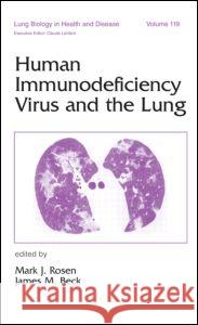 Human Immunodeficiency Virus and the Lung Mark J. Rosen James M. Beck 9780824798833