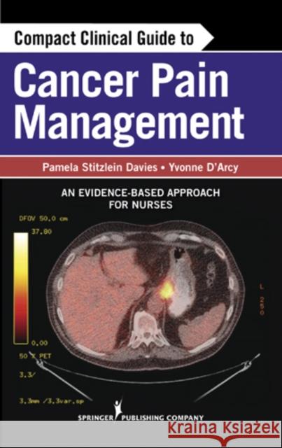 Compact Clinical Guide to Cancer Pain Management: An Evidence-Based Approach for Nurses Davies, Pamela 9780826109736 0