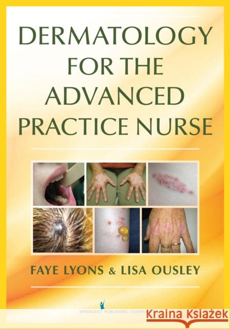 Dermatology for the Advanced Practice Nurse Faye Lyons Lisa Ousley 9780826136435 Springer Publishing Company