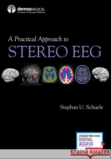 A Practical Approach to Stereo Eeg Stephan Schuele 9780826136923 Demos Medical Publishing