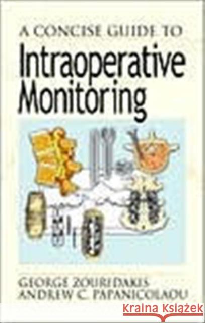 A Concise Guide to Intraoperative Monitoring George Zouridakis Andrew C. Papanicolaou 9780849308864 CRC Press