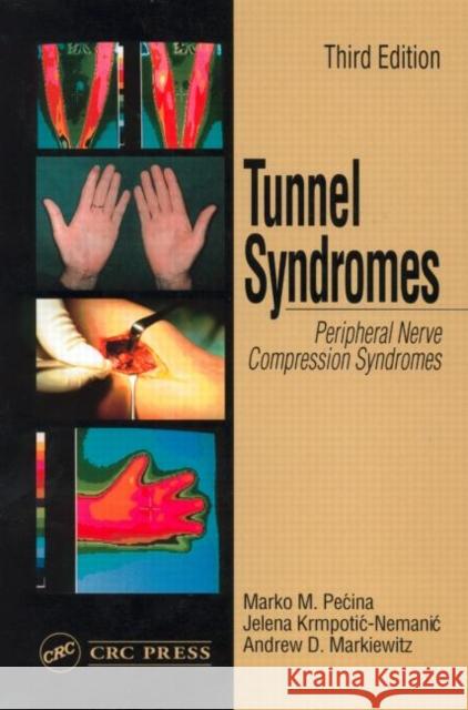 Tunnel Syndromes Marko M. Pecina Jelena Krmpotic-Nemanic Andrew D. Markiewitz 9780849309526 CRC Press