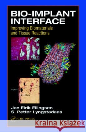 Bio-Implant Interface : Improving Biomaterials and Tissue Reactions J. E. Ellingsen Jan Eirik Ellingsen S. Petter Lyngstadaas 9780849314742 CRC Press