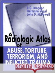 A Radiologic Atlas of Abuse, Torture, Terrorism, and Inflicted Trauma B. G. Brogdon Hermann Vogel John D. McDowell 9780849315336