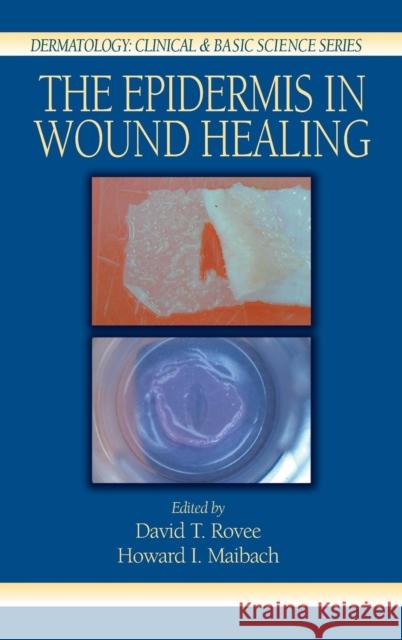 The Epidermis in Wound Healing David T. Rovee Howard I. Maibach Rovee T. Rovee 9780849315619 Informa Healthcare