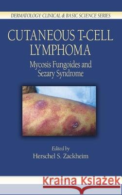 Cutaneous T-Cell Lymphoma: Mycosis Fungoides and Sezary Syndrome Zackheim, Herschel S. 9780849321016