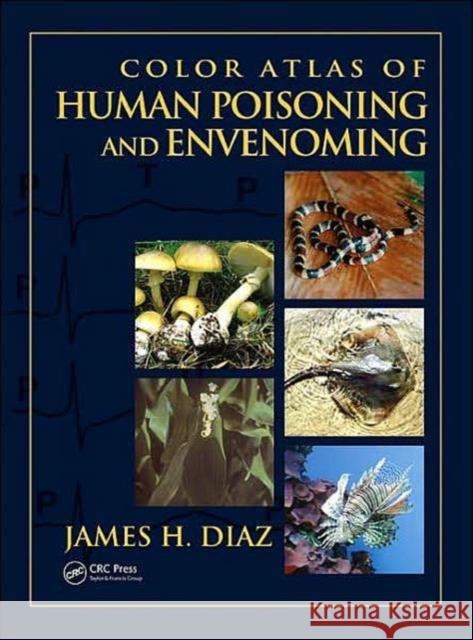 Color Atlas of Human Poisoning and Envenoming James Diaz 9780849322150