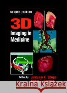 3D Imaging in Medicine, Second Edition Jayaram K. Udupa Gabor T. Herman 9780849331794 CRC Press