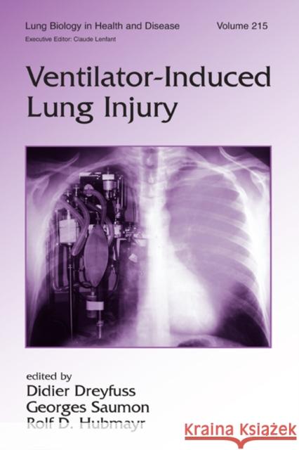 Ventilator-Induced Lung Injury Didier Dreyfuss Georges Saumon Rolf D. Hubmayr 9780849337161 Informa Healthcare