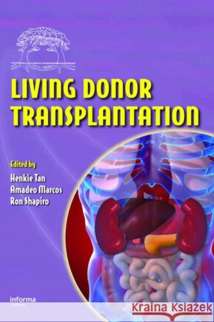 Living Donor Transplantation Henkie Tan Tan Tan Henkie Tan 9780849337666 Informa Healthcare