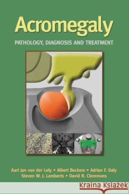 Acromegaly: Pathology, Diagnosis and Treatment Van Der Lely, Aart Jan 9780849338489 Marcel Dekker