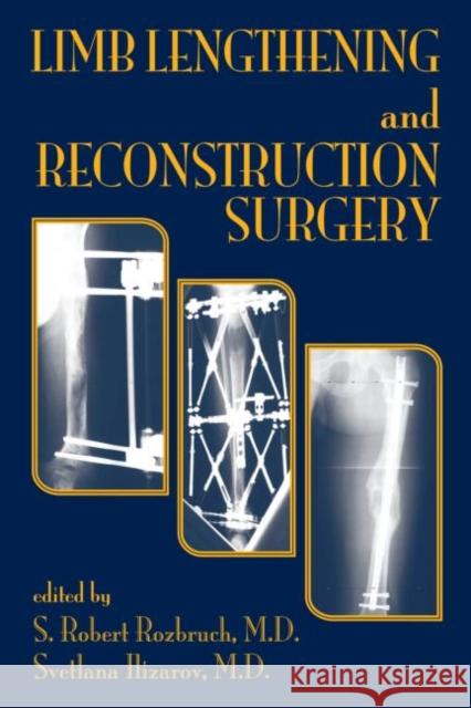 Limb Lengthening and Reconstruction Surgery S. Robert Rozbruch Rozbruch Robert Rozbruch S. Robert Rozbruch 9780849340512 