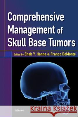 Comprehensive Management of Skull Base Tumors Hanna Y. Hanna Ehab Y. Hanna Ehab Y. Hanna 9780849340543 Informa Healthcare