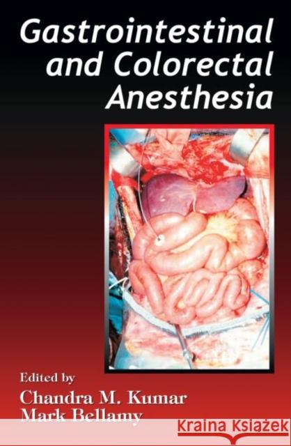 Gastrointestinal and Colorectal Anesthesia Chandra M. Kumar Mark Bellamy 9780849340734 Informa Healthcare