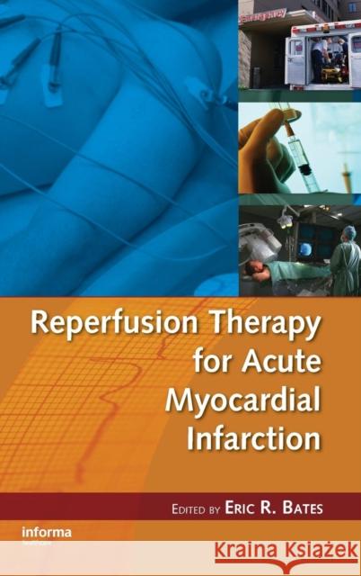 Reperfusion Therapy for Acute Myocardial Infarction Eric R. Bates Bates R. Bates Eric R. Bates 9780849343582