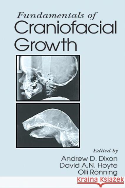 Fundamentals of Craniofacial Growth Andrew D. Dixon Clli R. Cnning Olli R. Onning 9780849345753 CRC Press