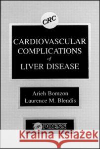 Cardiovascular Complications of Liver Disease Arieh Bomzon Laurence M. Blendis Bomzon Bomzon 9780849347351 CRC