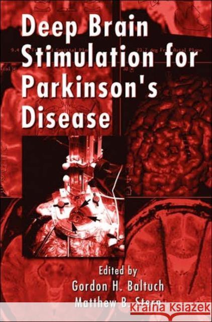 Deep Brain Stimulation for Parkinson's Disease Baltuch H. Baltuch Gordon H. Baltuch Gordon H. Baltuch 9780849370199 Informa Healthcare