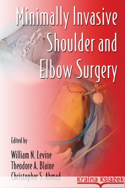 Minimally Invasive Shoulder and Elbow Surgery William N. Levine Theodore A. Blaine Christopher S. Ahmad 9780849372155 Informa Healthcare