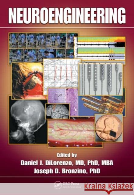 Neuroengineering Dilorenzo J. Dilorenzo Daniel J., MD Dilorenzo Daniel J., MD Dilorenzo 9780849381744