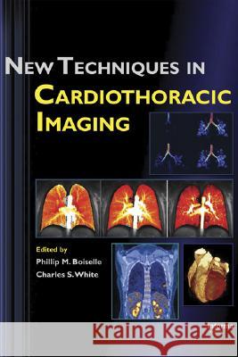 New Techniques in Cardiothoracic Imaging Boiselle M. Boiselle Philip M. Boiselle Philip M. Boiselle 9780849390197 Informa Healthcare
