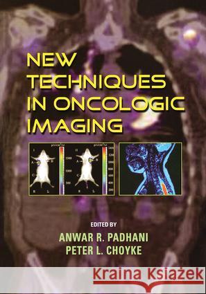 New Techniques in Oncologic Imaging Padhani Anwar R                          Choyke Peter L 9780849392740 Taylor & Francis Group