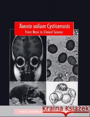 Taenia Solium Cysticercosis: From Basic to Clinical Science G. Singh S. Prabhakar Gagandeep Singh 9780851996288 CABI Publishing