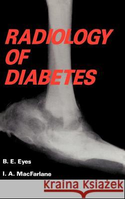 Radiology of Diabetes B. E. Eyes I. MacFarlane 9780852009369 Springer