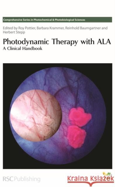 Photodynamic Therapy with ALA : A Clinical Handbook   9780854043415 