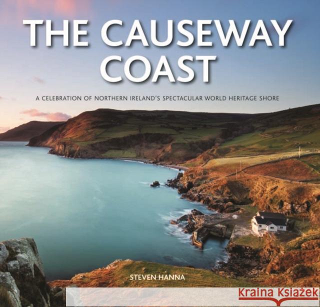 The Causeway Coast Steven Hanna 9780857043047 