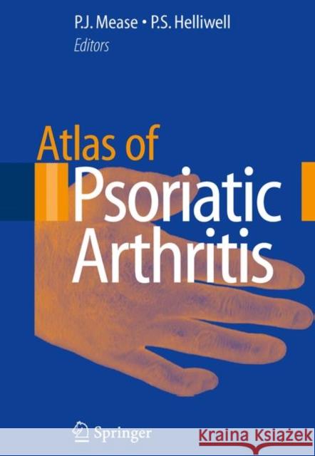 Atlas of Psoriatic Arthritis Philip J. Mease Philip S., DM Helliwell 9780857291745