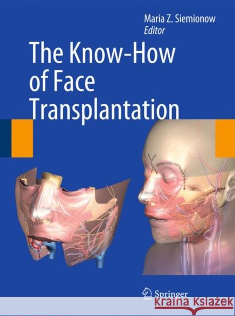 The Know-How of Face Transplantation Maria Z. Siemionow 9780857292520