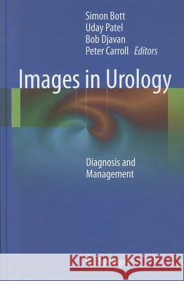 Images in Urology: Diagnosis and Management Bott, Simon 9780857297686 Springer